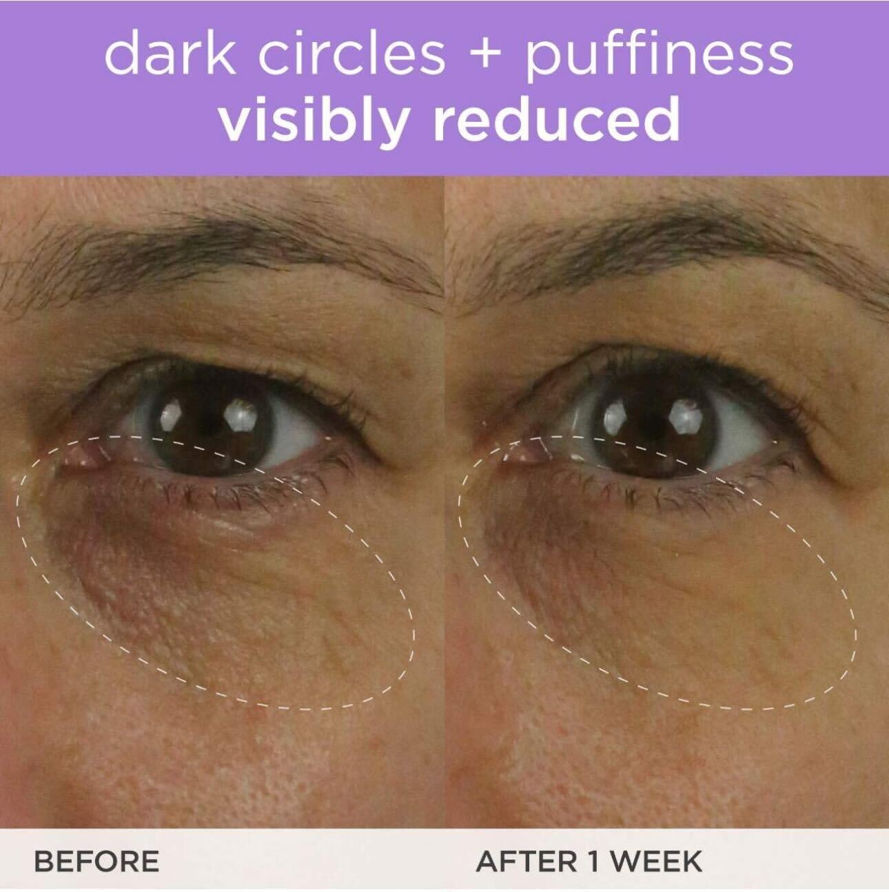 imageTATCHA The Brightening Eye Cream  Brightening ampamp Dark Circle Reduction with Vitamin C for Bight Firm Undereyes 15 ml  05 fl oz