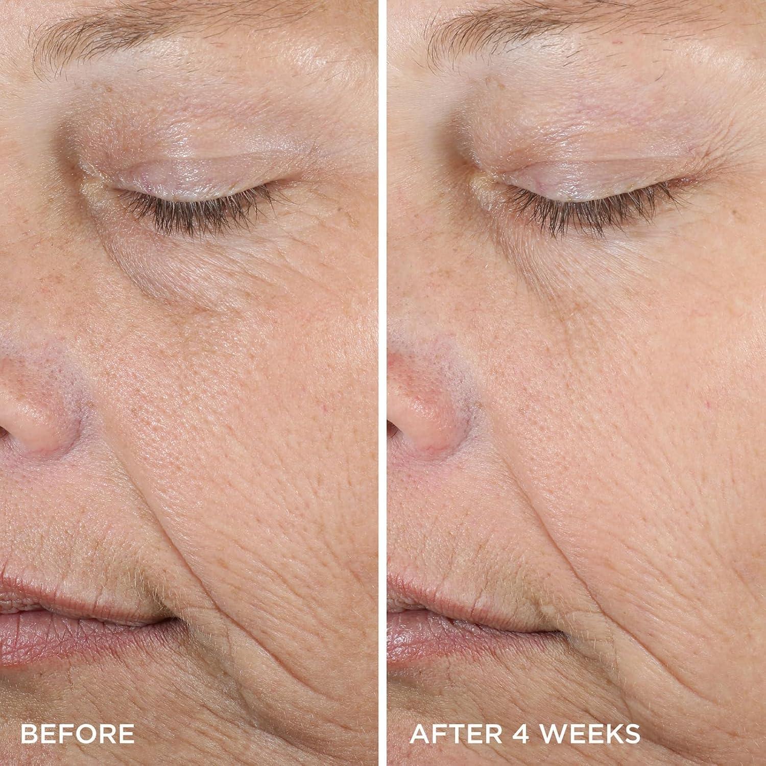 imageTatcha The Dewy Serum  Hydrating Serum for Smoother Plumper ampamp Dewy Skin  30 ml  1 oz